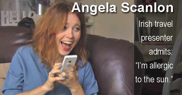 Angela Scanlon - Irish travel presenter admits: “I’m allergic to the sun.”