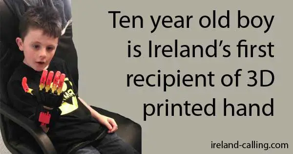 10 year old boy Ireland's first recipient of 3D printed hand