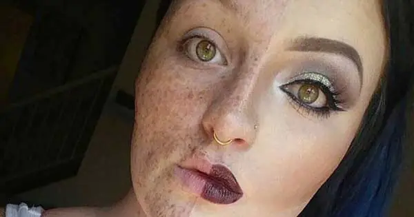 Freckled woman hits back at trolls with half and half selfie